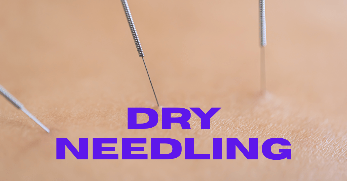 Dry Needling Therapy — Trigger Point Release & Deep Pain Relief in Bangladesh