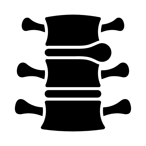 Prolapse Lumbar Intervertebral Disc Treatment