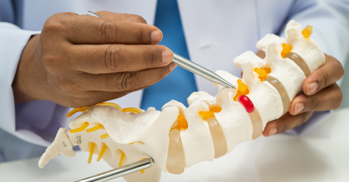 plid treatment in bangladesh